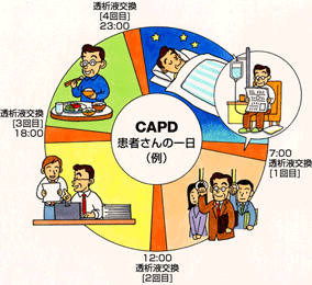 腹膜透析治療　図3